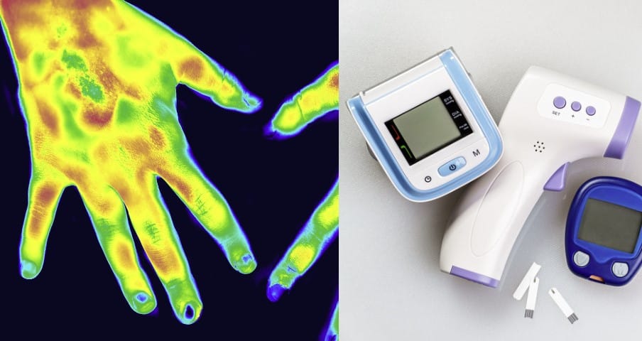 termografía para el sector de la medicina